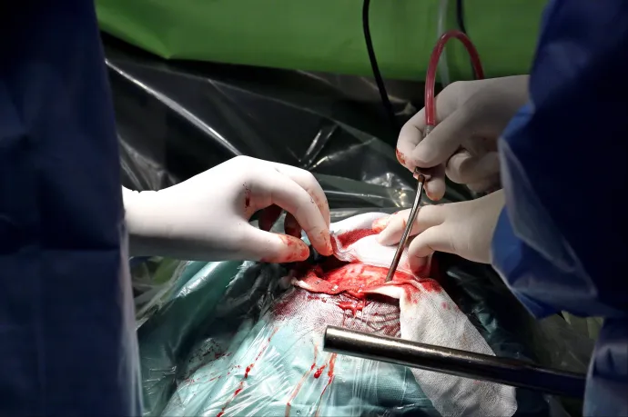 Egészségügyi adatelemzőt keres az OKFŐ, a kórházi fertőzésekről szóló Direkt36-os cikkek megjelenése után jelent meg az álláshirdetés