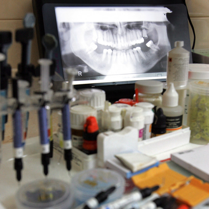 A fogorvosi ellátások kétharmadát saját zsebből fizetik a magyarok