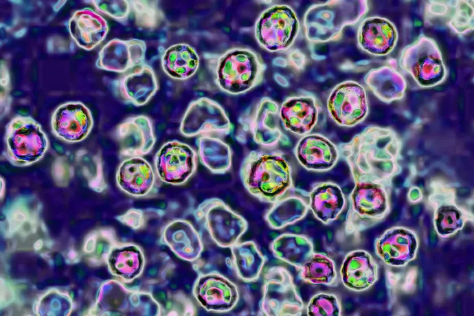 A kanyaróvírus mikroszkopikus nézete – Fotó: Bsip / Getty Images