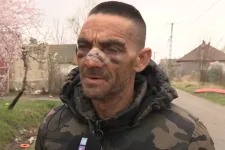 Órákig kínozhattak egy roma férfit Cegléd környékén