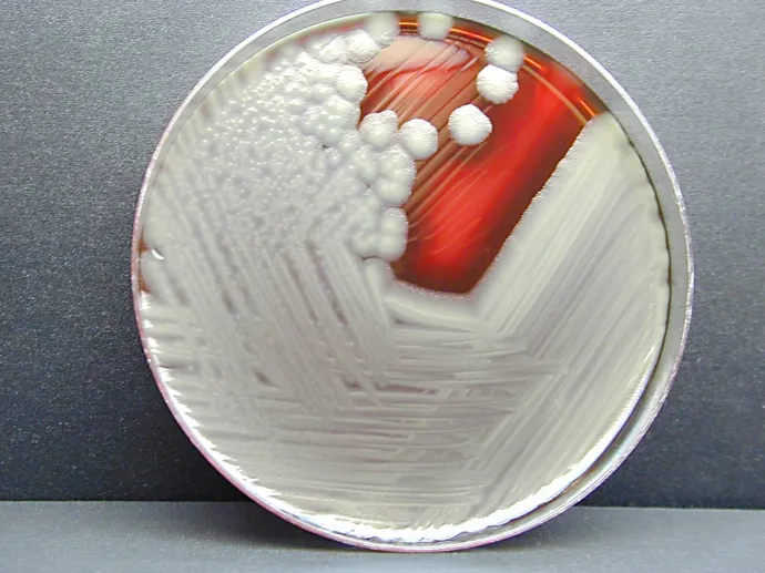 Bacillus cereus-tenyészet – Fotó: Smith Collection / Gado / Getty Images
