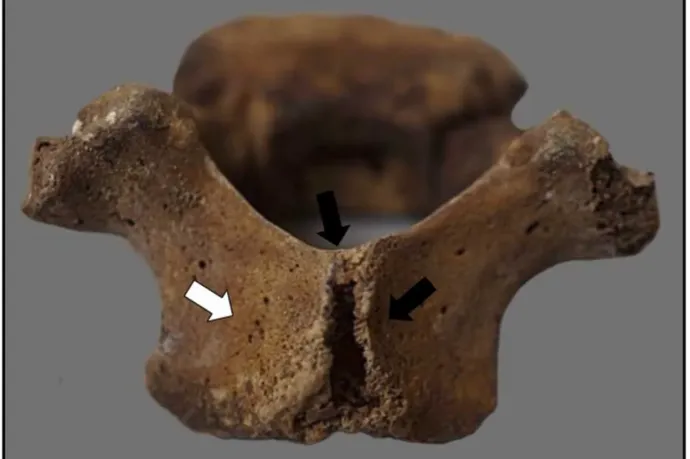 Himlős inka gyerekek 500 éves maradványait találták meg Peruban