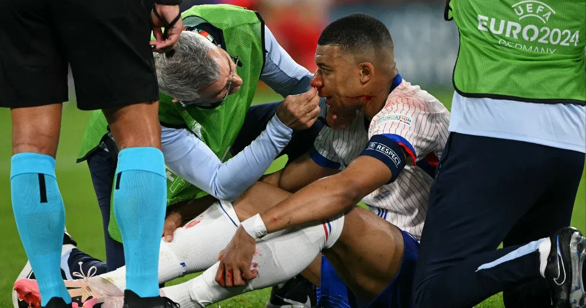 Mbappé a törött orra miatt maszkban fog játszani az Eb-n