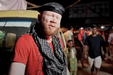 Aranyhal, a fekete albínó filmsztár szívesen lenne főgonosz egy James Bond-filmben