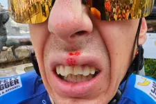 El sem kezdődött a Tour de France, de az egyik bringás máris bukott egy néző miatt, három foga bánta