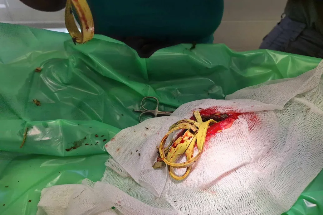 Nem tudott repülni a dunántúli gólyafióka, felnyitották a gyomrát, 380 gramm gumiszalagot találtak benne