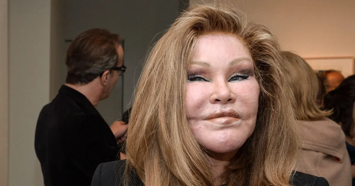 Meghalt az extrém plasztikai műtétjeiről ismert celeb, Jocelyne Wildenstein