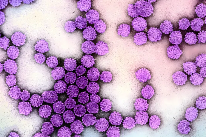 Akár 40 százalékkal is nagyobb lehet a szívbetegség kockázata a HPV-fertőzötteknél