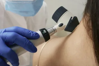 Az UV-sugárzás okozza a melanómás megbetegedések több mint 80 százalékát világszerte, mondja a Nemzetközi Rákkutató Ügynökség