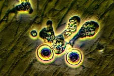 Naegleria nemzetségű amőbákat találtak a párkányi termálfürdőben, ahol járt az agyevő amőba miatt meghalt kisfiú