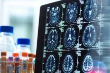 A lítium lehet a válasz az Alzheimer-kórra
