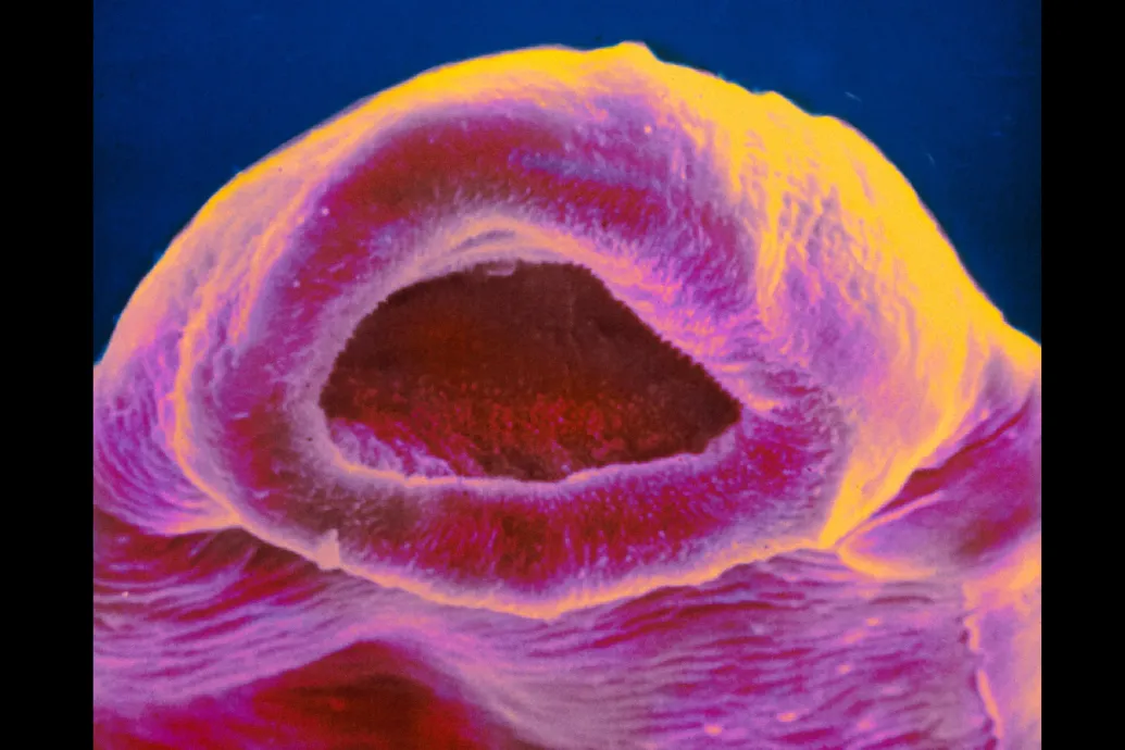 Kikapcsolja a szervezet fájdalomérzékelését egy emberre is veszélyes féreg