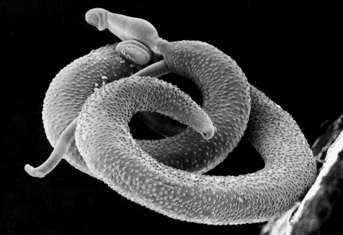 Schistosoma mansoni – Fotó: USUHS / Wikipedia
