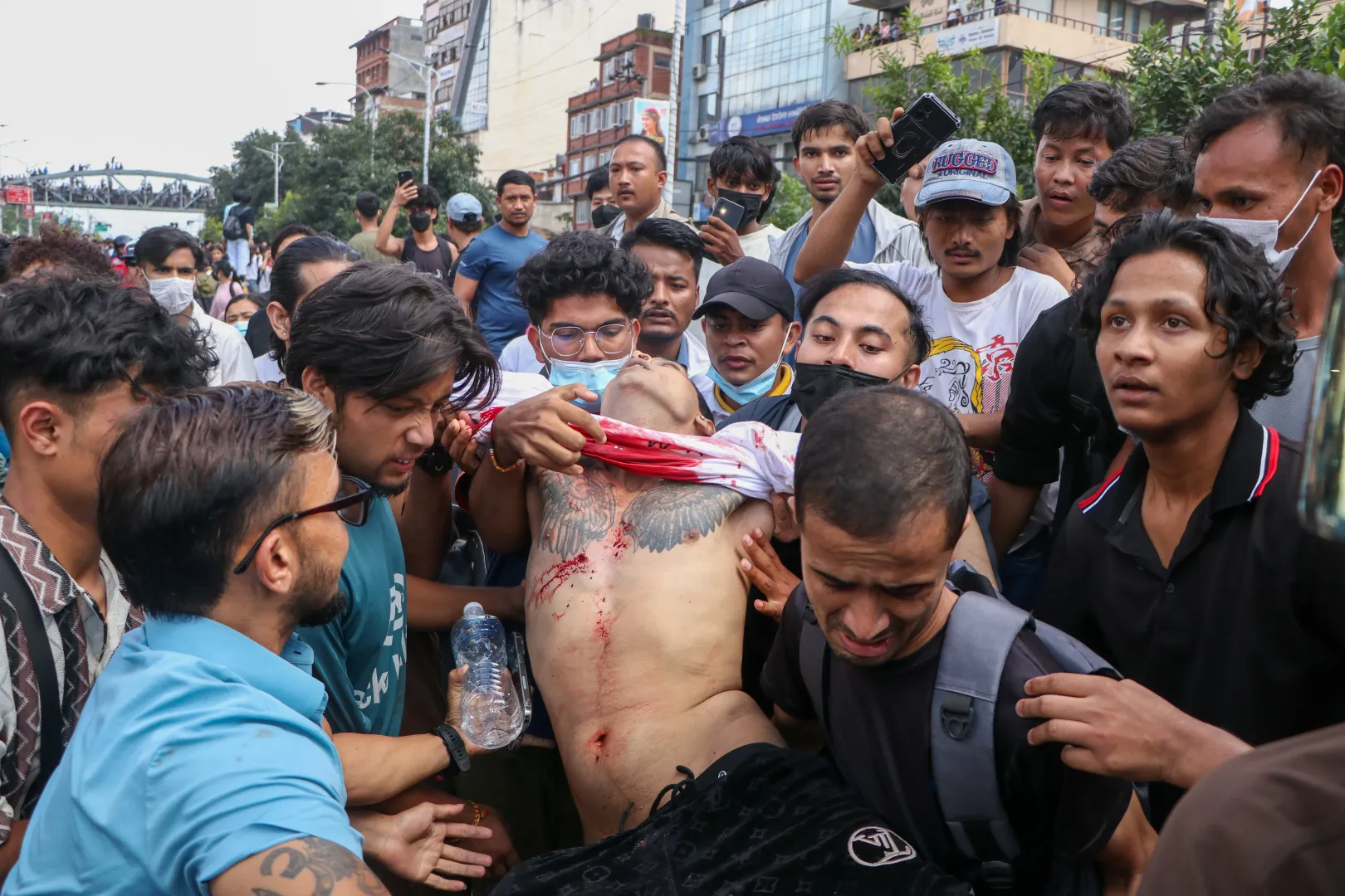 Sebesült tüntetőt visznek Katmanduban, 2025. szeptember 8-án. Fotó: Sunil Pradhan / Anadolu / Getty Images