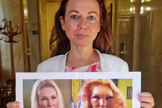 Megvonják Szabó Tímea fizetését, amiért a megvert Orosz Bernadett fényképével szemléltette a kapcsolati erőszakról szóló javaslatát