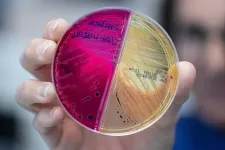 Semmit nem érnek a drágán árult mikrobiomtesztek, mert még azt se tudjuk, milyen az egészséges mikrobiom