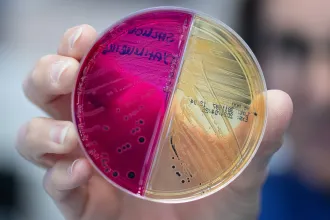 Semmit nem érnek a drágán árult mikrobiomtesztek, mert még azt se tudjuk, milyen az egészséges mikrobiom