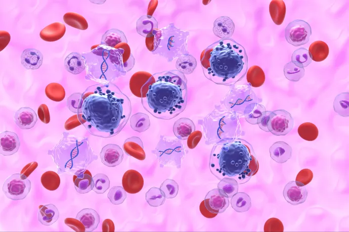 Egy kísérleti immunterápia kikapcsolhatja a leukémiás sejtek rejtőzködő mechanizmusát