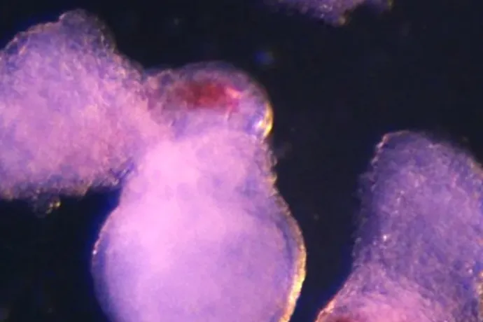 Emberi vért állítottak elő laboratóriumban, és ez új utakat nyithat a gyógyászatban