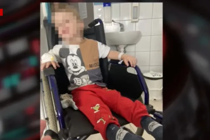 „Nincs röntgenszemünk” – mondták egy anya szerint a bölcsődei dolgozók, miután eltört a fia combcsontja