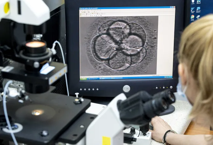 Megtermékenyített petesejt mikroszkópképe a Szent János Kórház felújított Budai Meddőségi Centrumában, 2020. június 16-án – Fotó: Szigetváry Zsolt / MTI