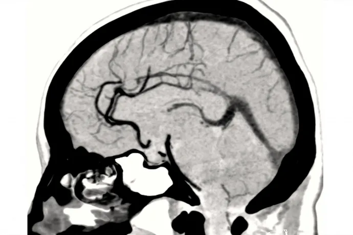 Egy kutatócsoport rájött, hogy mi a közös az emberi agyban és a részvénypiacban