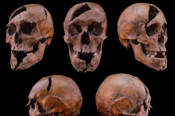 Tényleg egy magyar herceget kaszaboltak le a Margit-szigeten