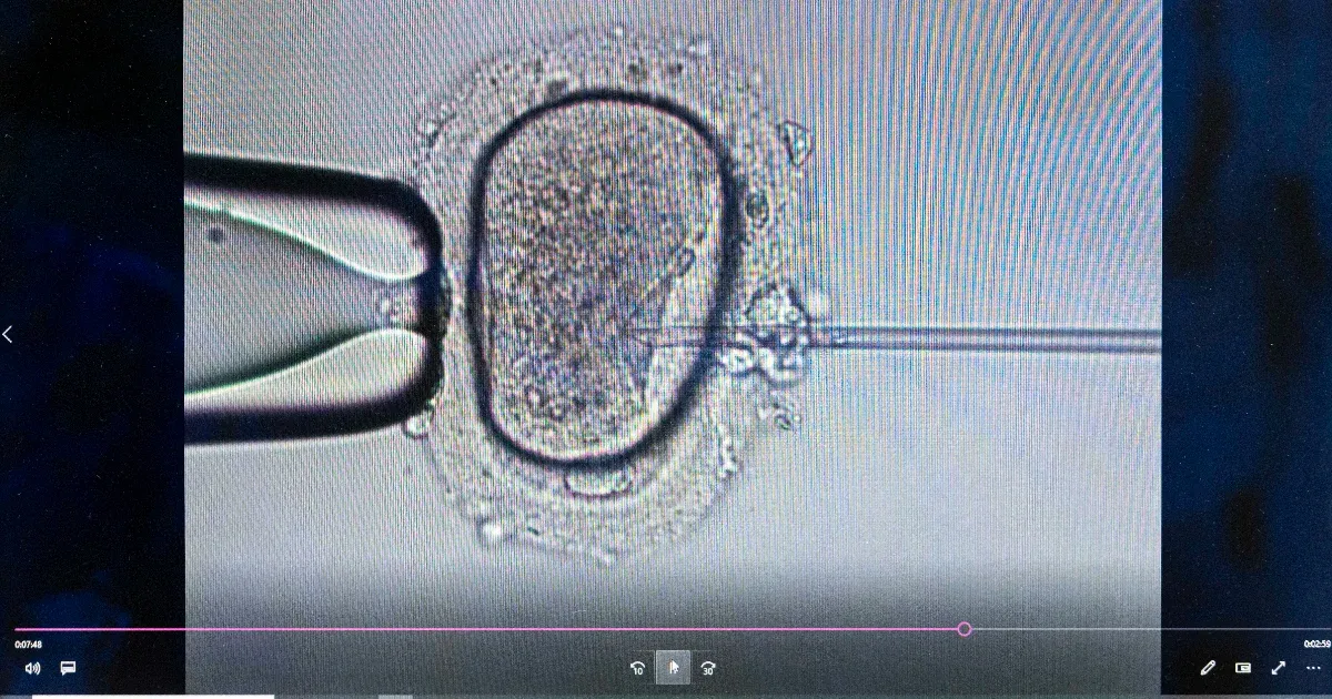 Decemberre csúszik a petesejt-donációs törvényjavaslatról szóló parlamenti szavazás