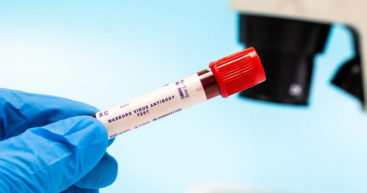 Egy ebolaszerű vírus miatt járványhelyzetet hirdettek Etiópiában