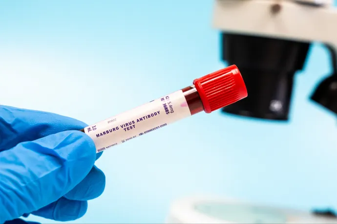 Ebolaszerű vírus jelent meg Etiópiában, már kilenc esetet azonosítottak