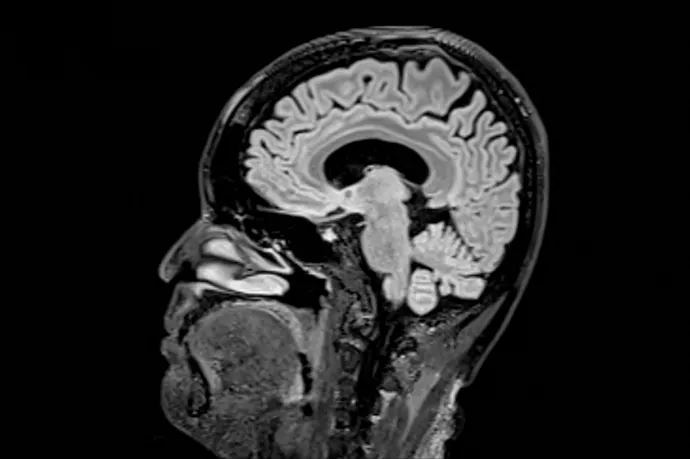 Korszakai vannak az agyunknak, és a felnőttkort 30 év alatt el sem éri