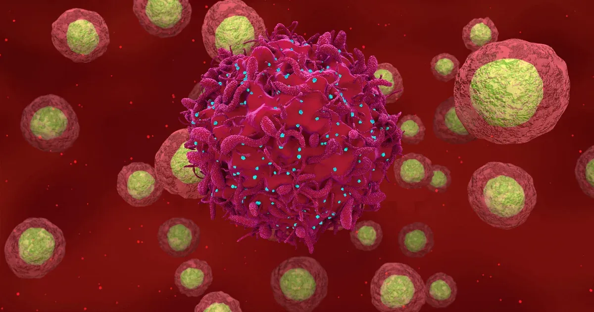 A leukémiája miatt kapott őssejtterápiát, váratlanul a HIV-ből is kigyógyult egy férfi