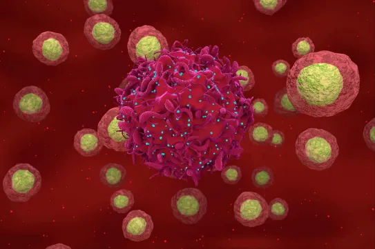 A leukémiája miatt kapott őssejtterápiát, váratlanul a HIV-ből is kigyógyult egy férfi