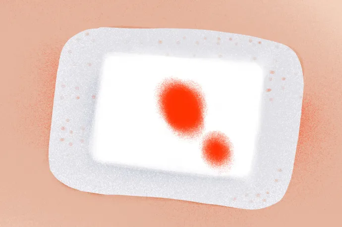 Tálos Atanáz: Kés