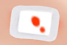 Tálos Atanáz: Kés