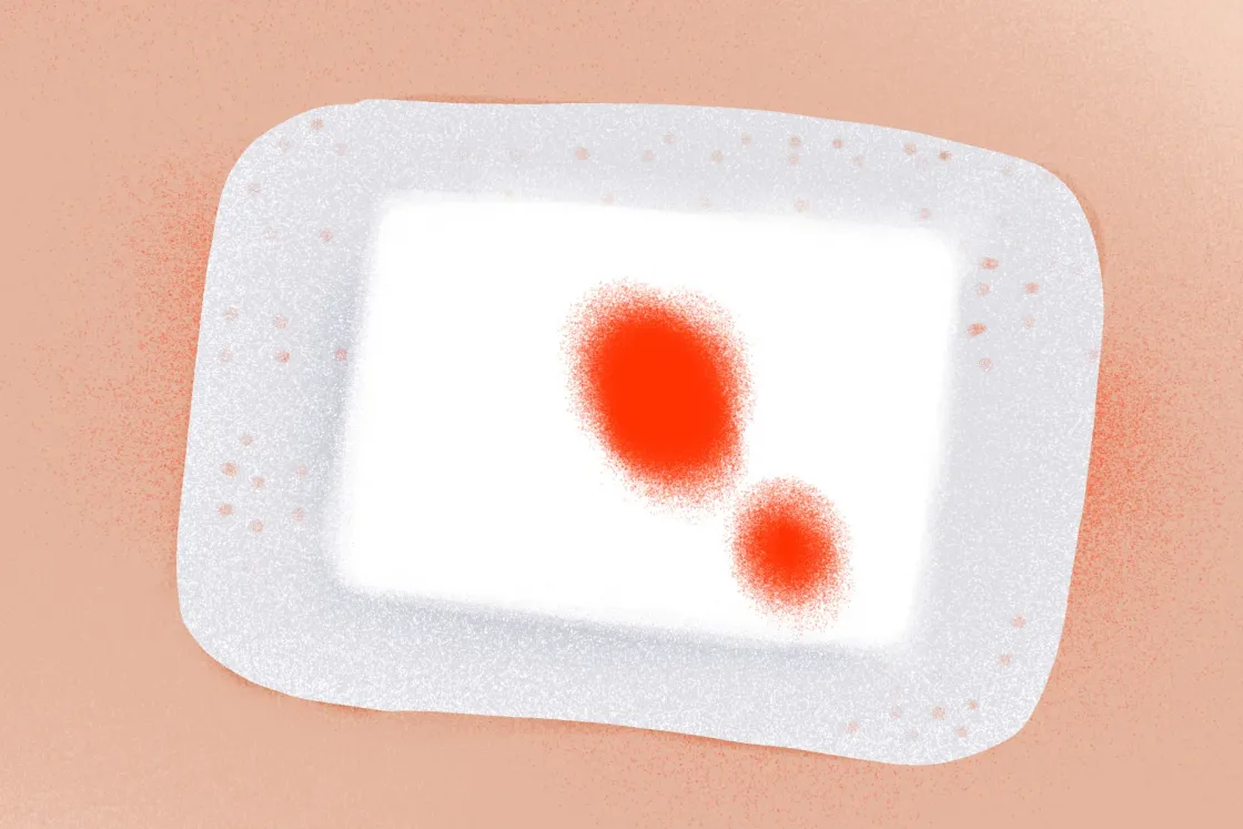 Tálos Atanáz: Kés