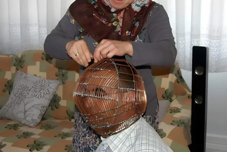 A férfi, aki fémketrecbe zárta a fejét, hogy leszokjon a cigizésről