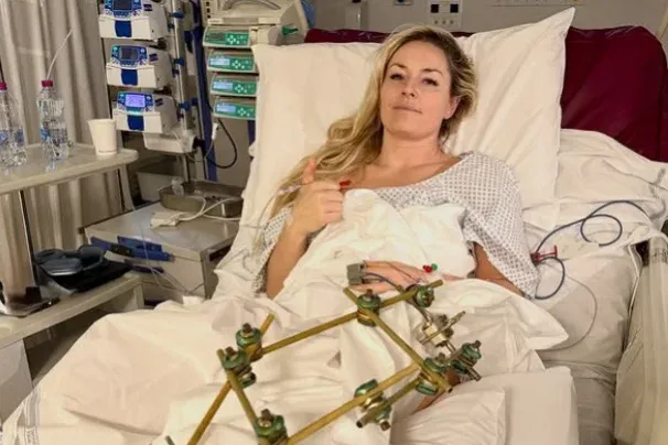 Fotót osztott meg magáról a kórházban fekvő Lindsey Vonn, akit harmadszor is megoperáltak