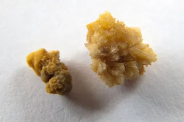 Drágakövek helyett csak a tulaj veseköveit zsákmányolták az olasz betörők