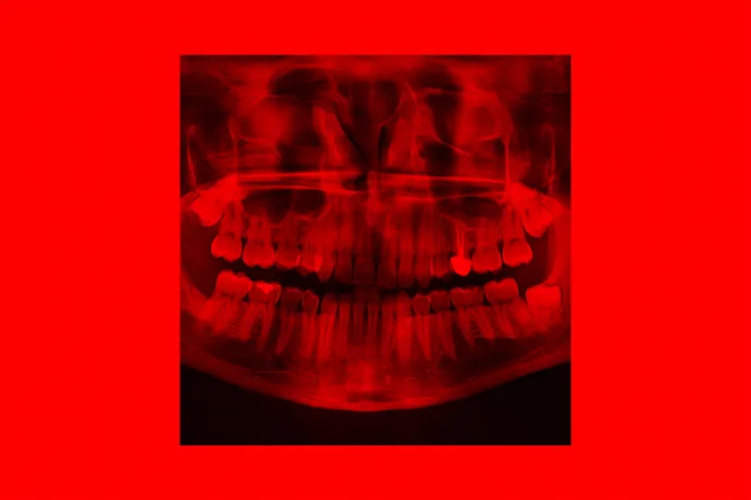 Nem mindegy, hogy Kőbánya alsó vagy Armani felső