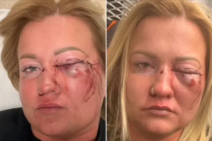 Lemondott a szentmártonkátai alpolgármester, akiről egy nő azt állítja, súlyosan bántalmazta