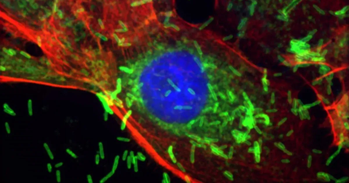 Egy ínybetegséget okozó baktérium segítheti a mellrák kialakulását