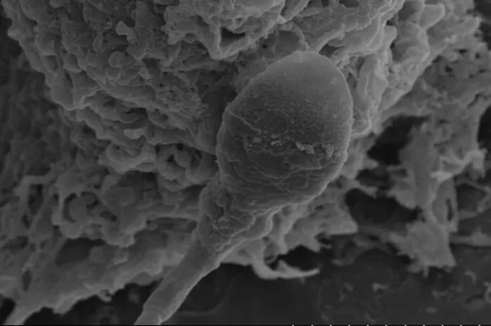 Figyelmeztetnek a tudósok: nehezebb lehet gyereket csinálni az űrben, mint eddig gondoltuk