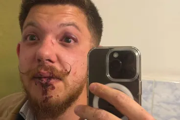 A Tisza-szlogen kiabálása miatt vertek véresre három fiatalt a Sepsi OSK edzői