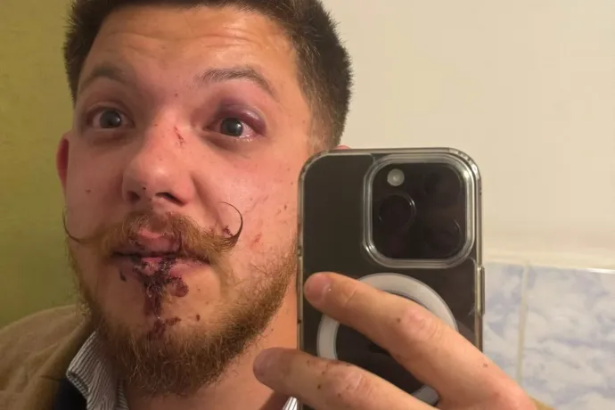 A Tisza-szlogen kiabálása miatt vertek véresre három fiatalt a Sepsi OSK edzői