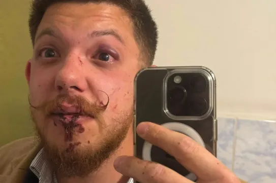 A Tisza-szlogen kiabálása miatt vertek véresre három fiatalt a Sepsi OSK edzői