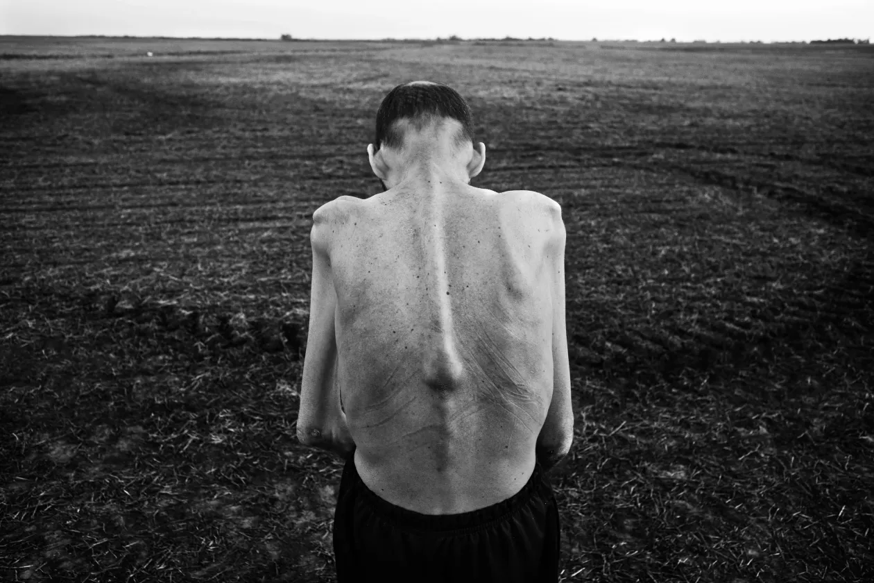 A 2018-ban meghalt Fabián Tomasi mezőgazdasági munkásként súlyos toxikus polineuropátiában szenvedett, és a mérgező vegyi anyagok elleni küzdelem globális szimbólumává vált.Entre Ríos, Argentína, 2016. október 25. / Mirta María Velzi meglátogatja lánya sírját, aki 17 éves korában agydaganatban halt meg. Apja évekig dolgozott olyan farmokon, ahol veszélyes vegyszereknek volt kitéve. Entre Ríos, Argentína, 2014. november 21. – Fotó: Pablo E. Piovano (Argentina, Manuel Rivera-Ortiz Foundation, Philip Jones Griffiths Foundation, Lawen.doc)