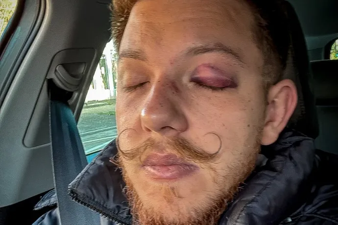 Csendes flashmobbal tiltakoznak Sepsiszentgyörgy főterén a Sepsi OSK vezetőinek erőszakos fellépése ellen