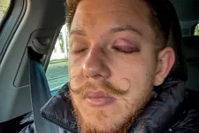 Csendes flashmobbal tiltakoznak Sepsiszentgyörgy főterén a Sepsi OSK vezetőinek erőszakos fellépése ellen