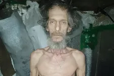 Kirúgtak egy ukrán parancsnokot, miután súlyosan alultáplált katonákról kerültek ki képek